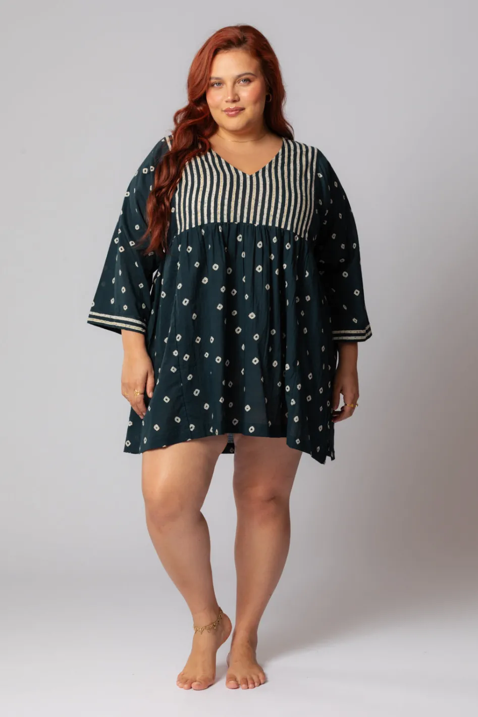 Fashion Essence Dress Dresses